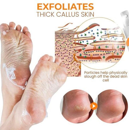 Oveallgo™ PediSoft Foot Callus Removal Spray