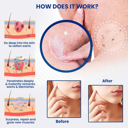 Fivfivgo™ WartsOff Instant Blemish Removal Cream