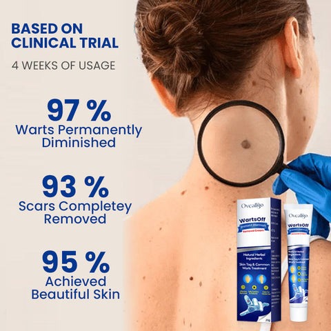 Fivfivgo™ WartsOff Instant Blemish Removal Cream
