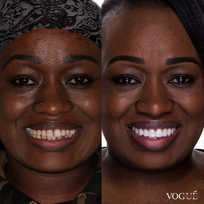 Teeth Color Corrector Serum – Instant Brightening with Purple Color-Correction