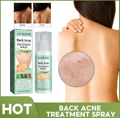 Back Acne Treatment Spray