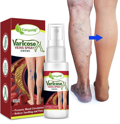 Herbal Varicose Vein Spray