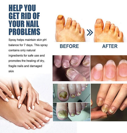 Medica™ Grade Anti-Fungal Nail Treatment Spray