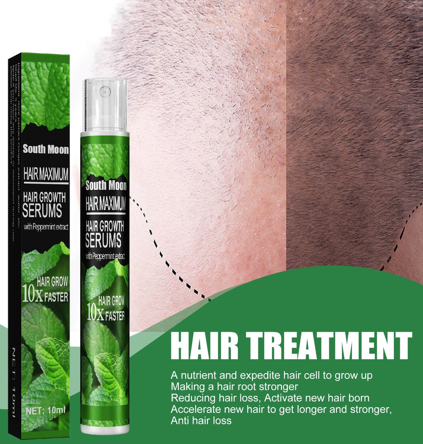HairRebirth herbal spray (3 pieces)