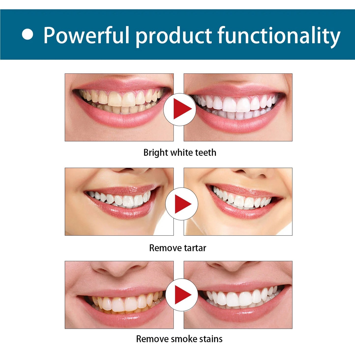 Gum Restoration Whitening Strips