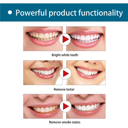 Gum Restoration Whitening Strips