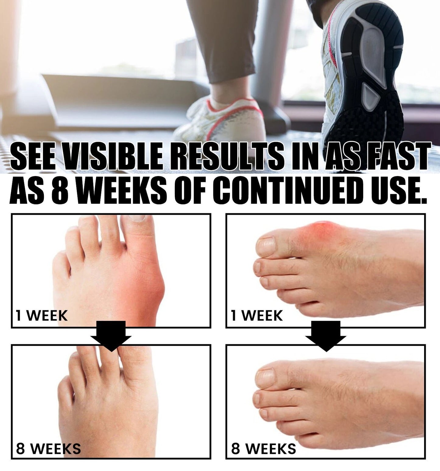 Orthoes™ Bunion Relief Socks