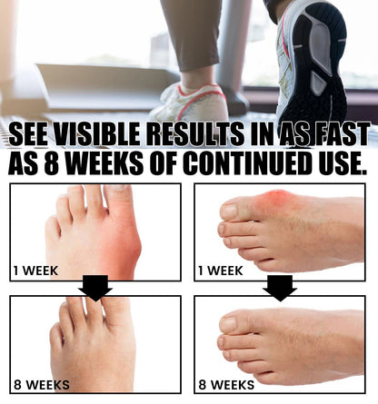 Orthoes™ Bunion Relief Socks
