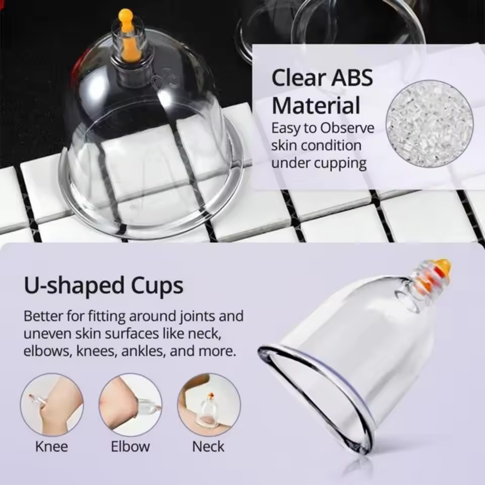 Professional Cupping Therapy Set – 12 Cup Massage & Recovery Kit