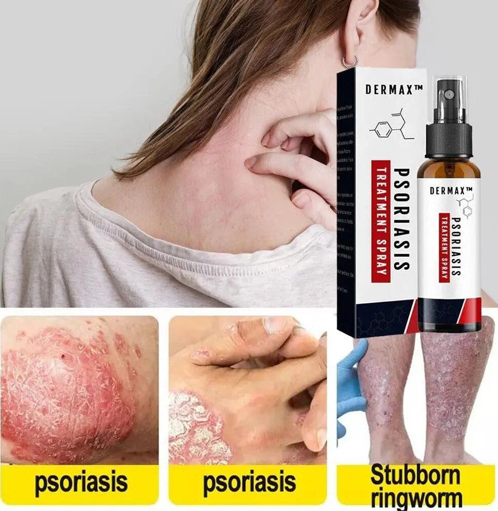Dermax™ Psoriasis Treatment Spray PRO