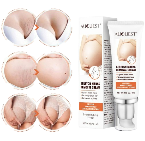 DERMEASE™ Stretchmarks Removal Cream