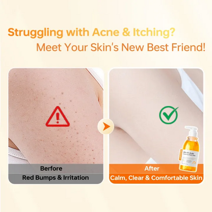 Moisturizing Gel – Deep Cleansing & Brightening Skin Care