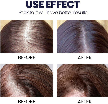 Ultra HairGrowth Formula Serum Spray