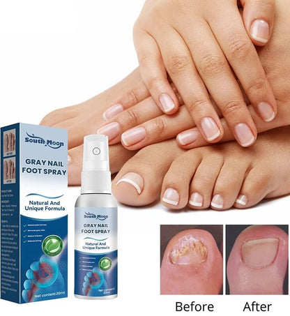 Medica™ Grade Anti-Fungal Nail Treatment Spray