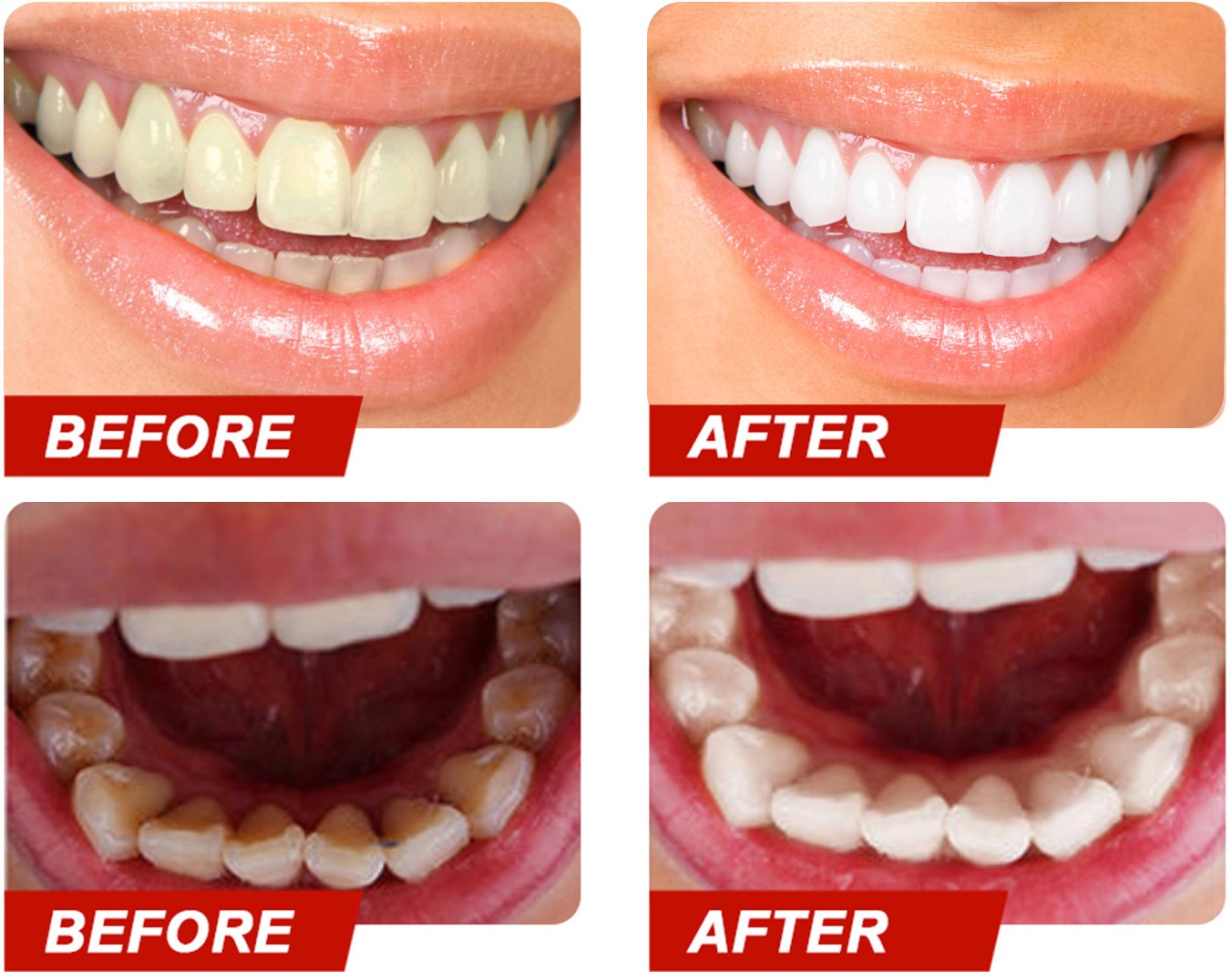 Teeth Colour Corrector Serum.