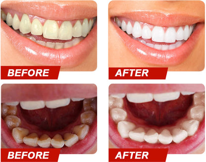 Teeth Colour Corrector Serum.