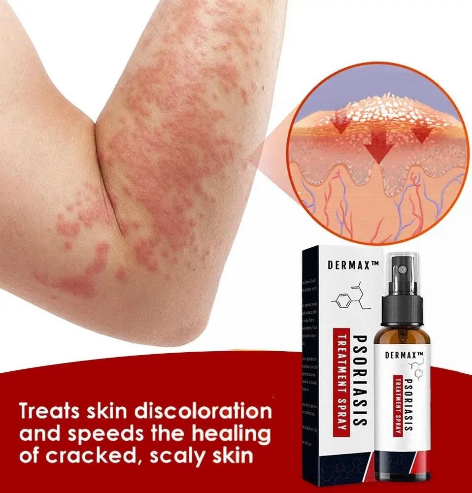 Dermax™ Psoriasis Treatment Spray PRO