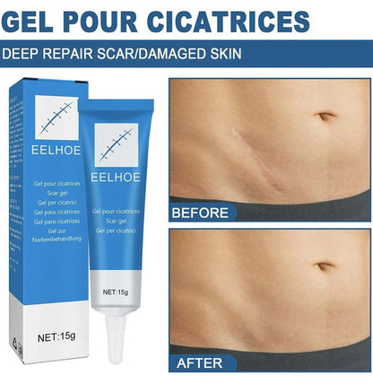 Organic Scar Removal Cream