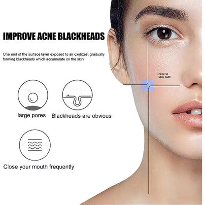 Green Tea Nose Mask – Peel-Off Blackhead Remover &amp; Pore Tightener