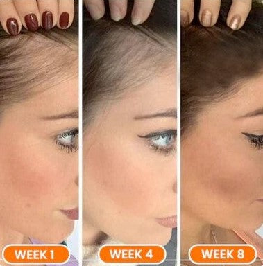 Liascy™ FINAS Hair-Regrowth Ampoules