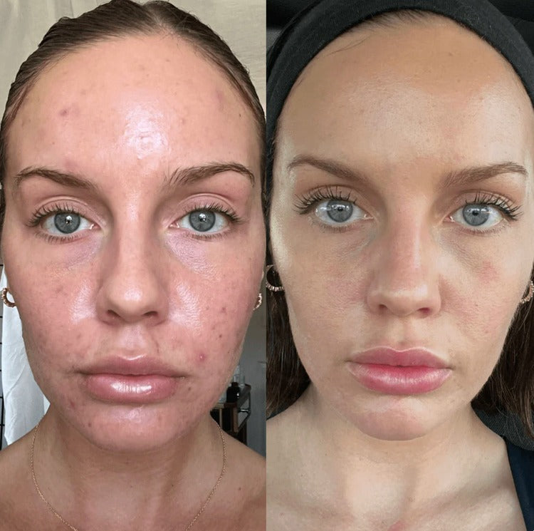 🍊 Orange Enzyme Exfoliating Gel – Smooth, Bright & Glowing Skin ✨