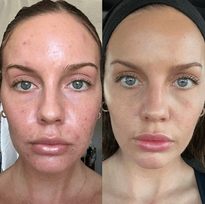 🍊 Orange Enzyme Exfoliating Gel – Smooth, Bright & Glowing Skin ✨