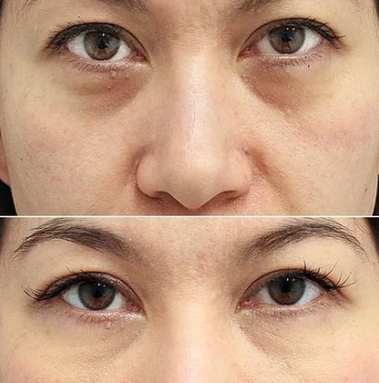 Electric Massage Eye Cream – Smooth, Firm & Refresh Tired Eyes