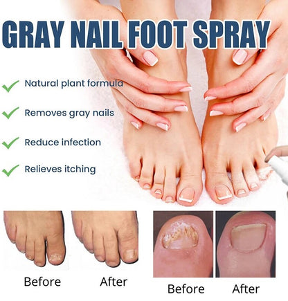 Medica™ Grade Anti-Fungal Nail Treatment Spray