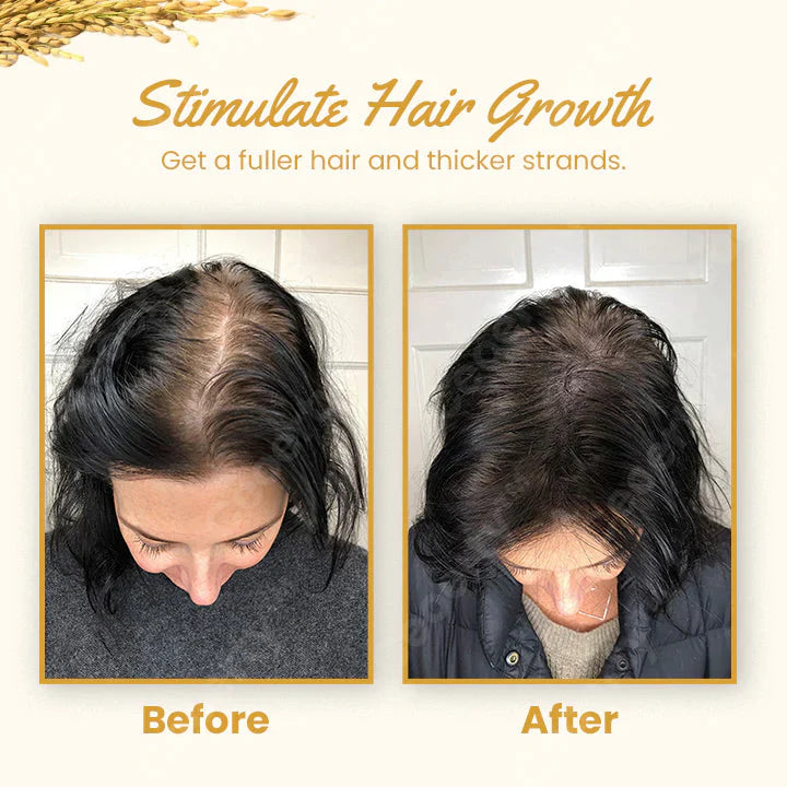 Ceoerty™ Hair Growth Rice Water