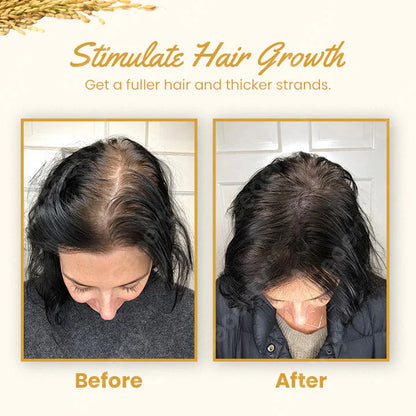 Ceoerty™ Hair Growth Rice Water