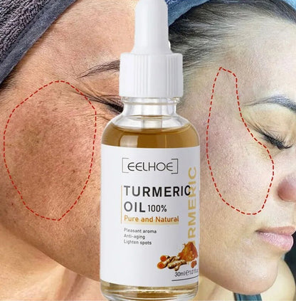 Turmeric Dark Spot Corrector Serum
