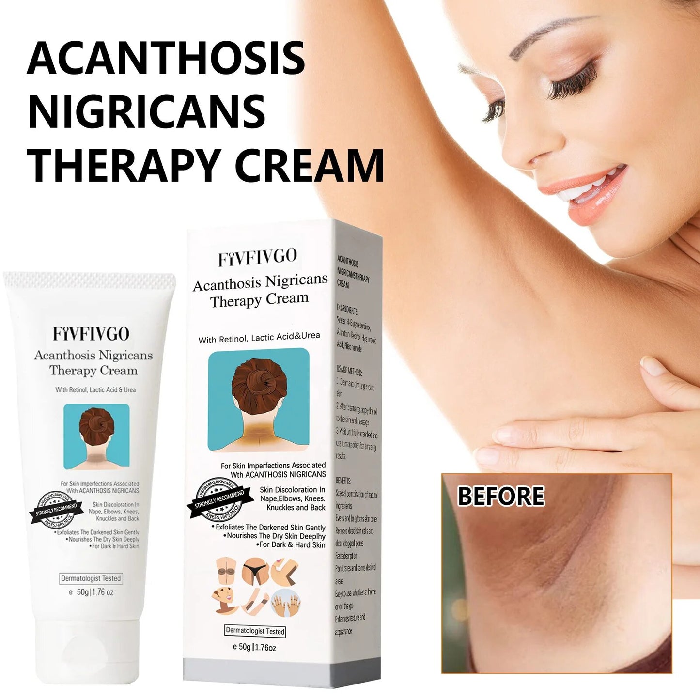 Acanthosis™ Nigricans Therapy Cream