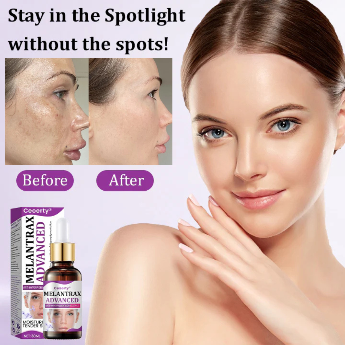 MelantraX Advanced Anti-Hyperpigmentation Essence