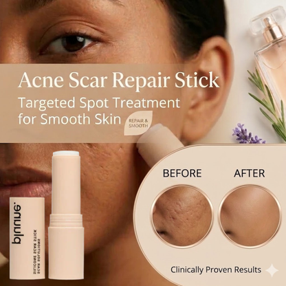 Acne Scar Repair Stick – Targeted Spot Treatment for Smooth Skin