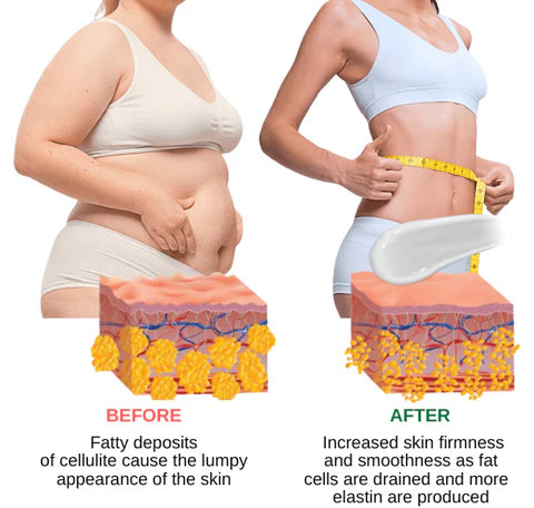 Slimming Cream