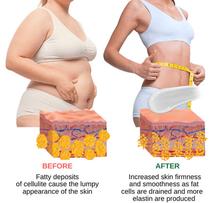 Slimming Cream