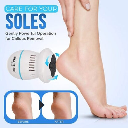 Pedi Vac Electric Callus Remover — Smooth Feet Care Tool