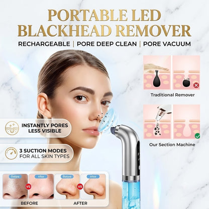 Portable LED Rechargeable Blackhead Remover