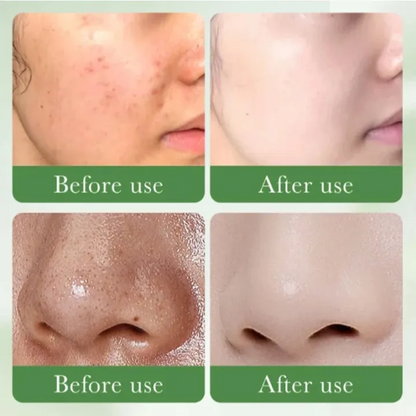 Centella Asiatica Facial Toner – Oil Control Hydrating Toner (200ml)