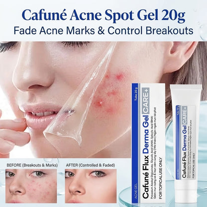 Cafuné Acne Spot Gel – Fade Acne Marks & Control Breakouts