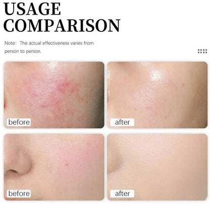 Enlan Vitamin C Face Cream – The Ocean Healed My Skin