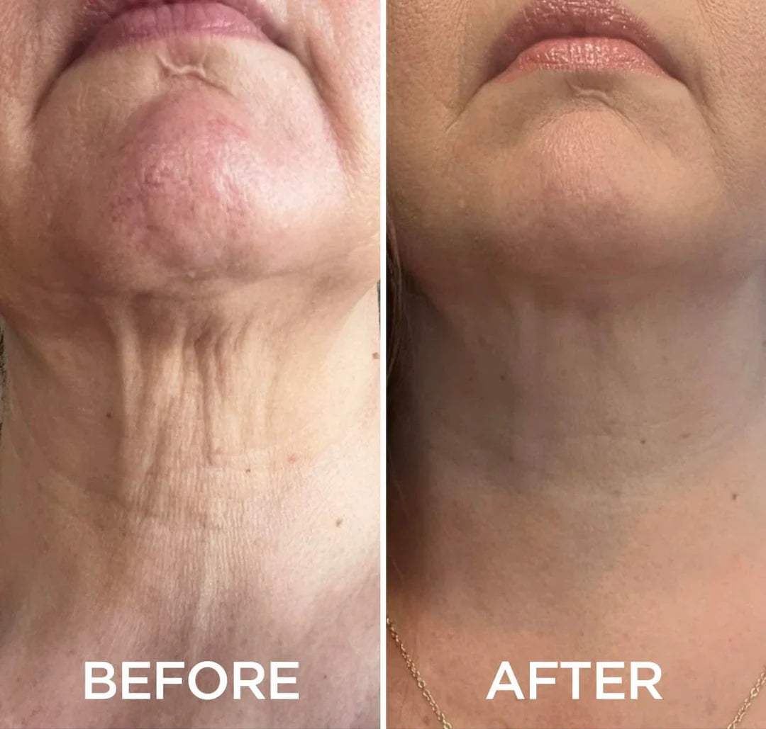 AH-8 Neck Firming Cream