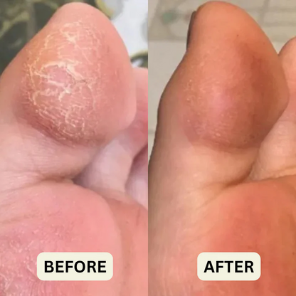 Deep Hydration Hand & Foot Balm Stick – Moisturizing Heel Care