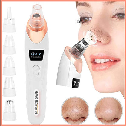 Electric Blackhead Remover Vacuum – Pore Cleaner with Multi-Level Suction