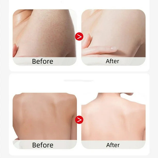 Non-greasy, anti-itch and deep moisturizing lotion