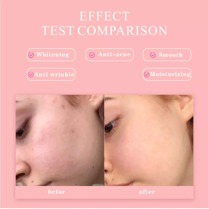 5-in-1 Hyaluronic Acid & Vitamin C Facial Serum