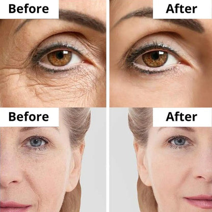 Anti Aging & Wrinkle Cream – Daily Care for Smoother Looking Skin