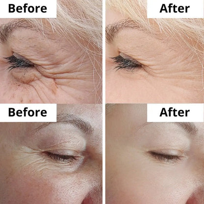Anti Aging & Wrinkle Cream – Daily Care for Smoother Looking Skin