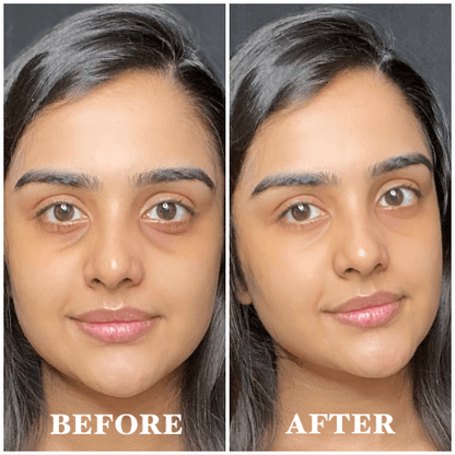 Eye Massage Oil – Brighten, De-Puff & Refresh Tired Eyes