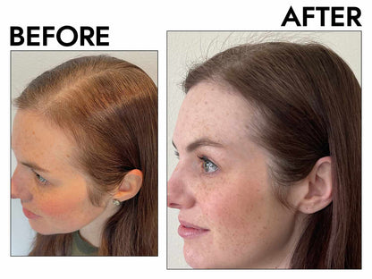 Anti-Hair Loss &amp; Hair Growth Shampoo